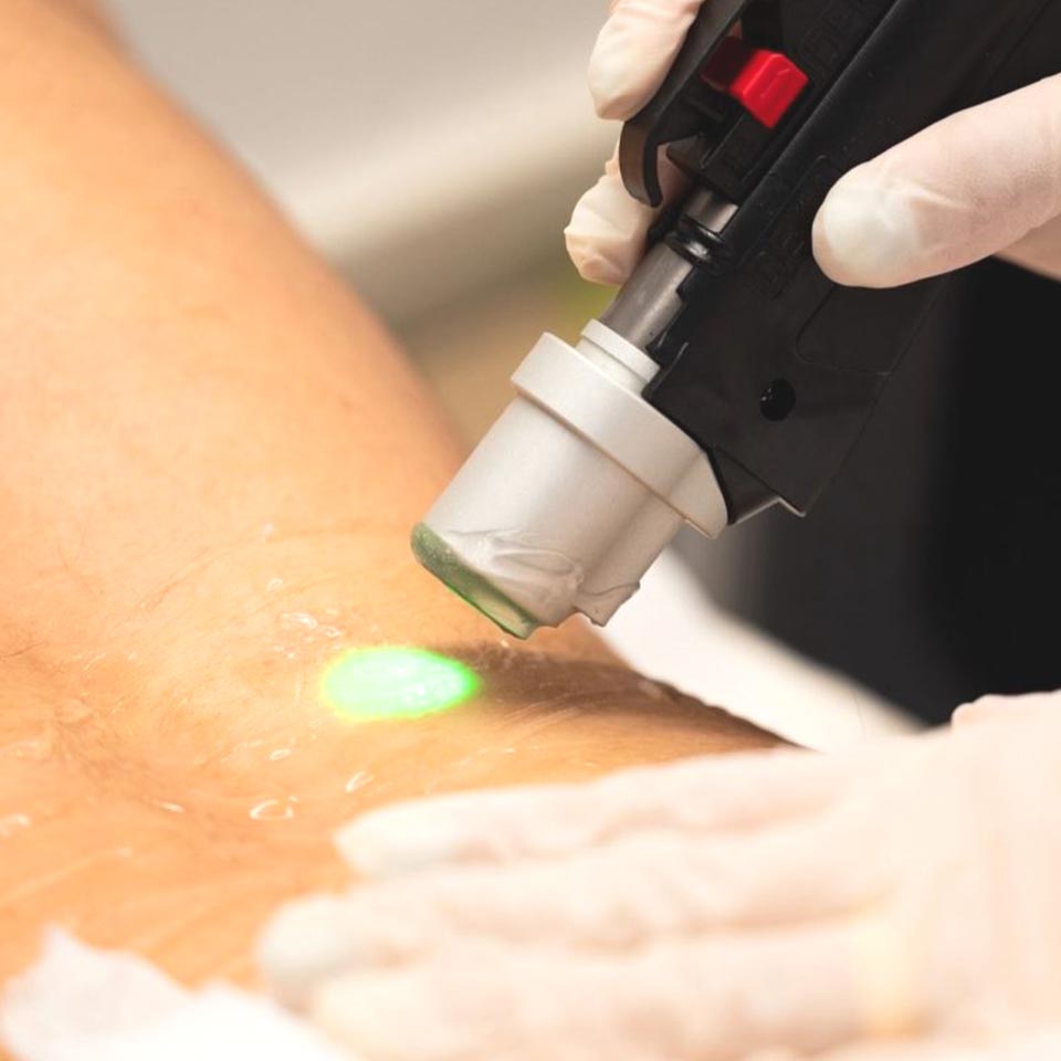 Deka Motus Pro w akcji