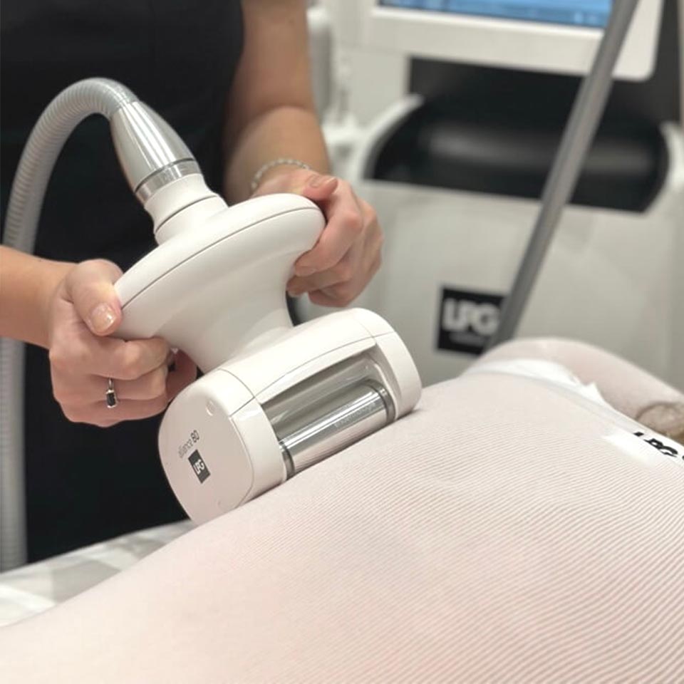 CELLU M6 Alliance® LPG