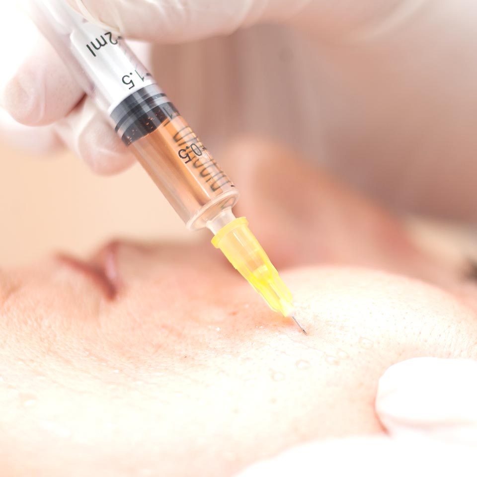 wampirzy lifting warszawa