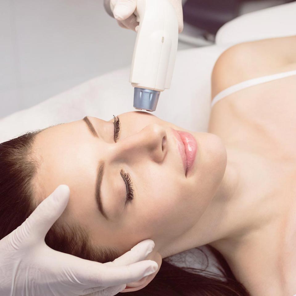 Depilacja laserowa twarzy