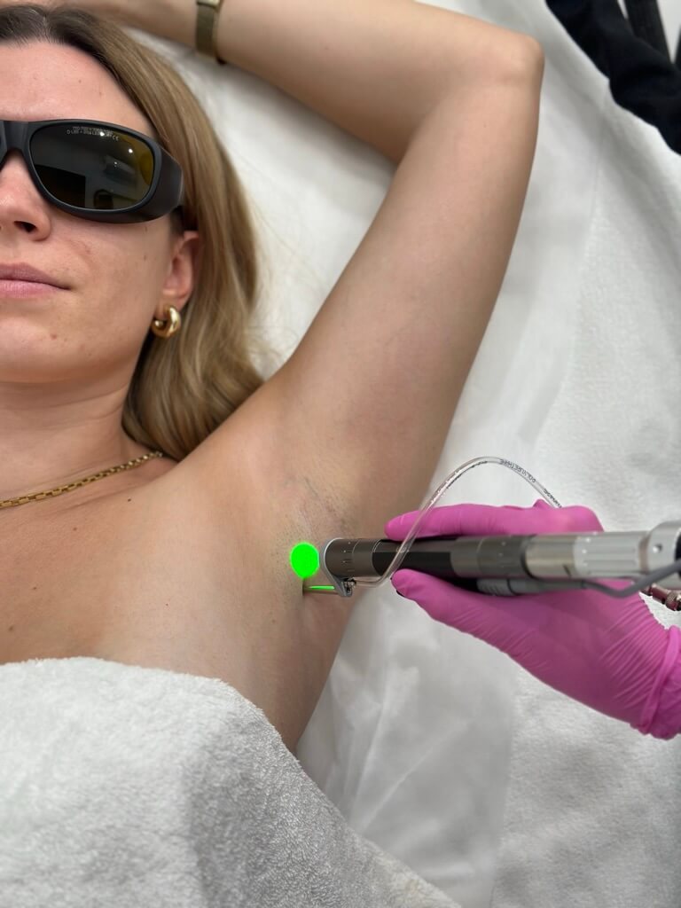 depilacja laserowa w Warszawie